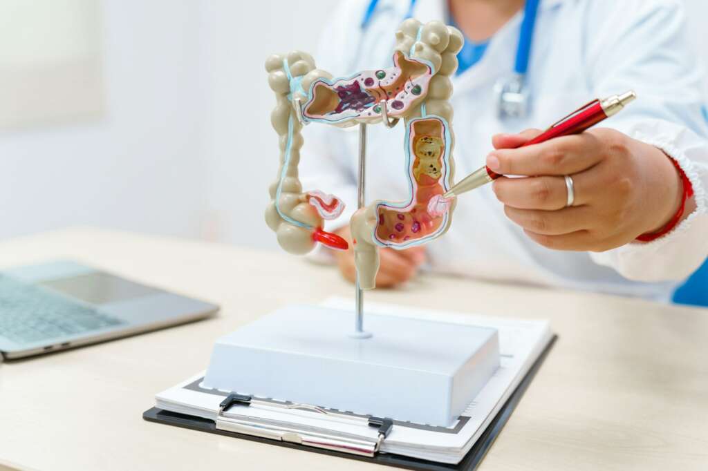 A doctor holds a human colon anatomy model, demonstrating the digestive system