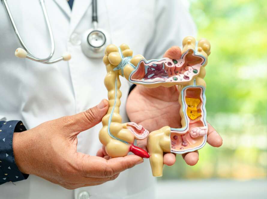 Intestine, appendix and digestive system, doctor holding anatomy model for study diagnosis